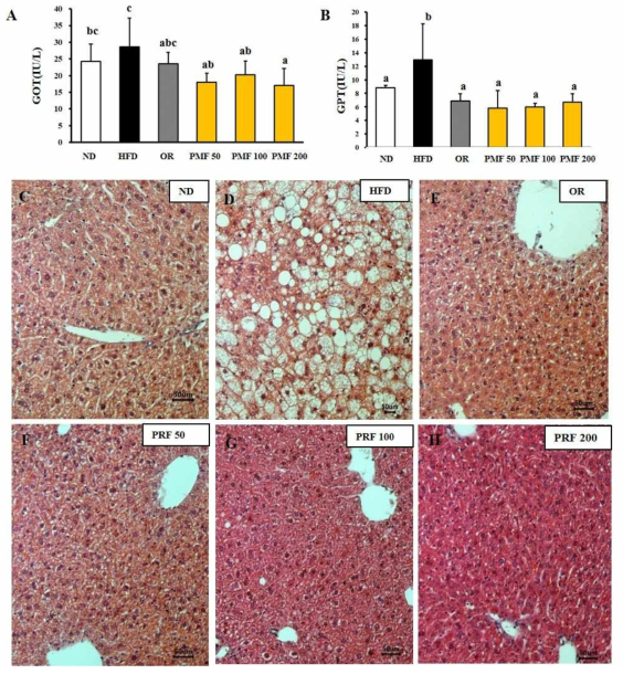 Effect of PRF on liver function in HFD induced obese mice. (A) GOT levels. (B) GPT levels. The liver section of ND (C), HFD (D), OR (E), PRE 50 (F), PRE 100 (G), and PRE 200 (F) stained with H HFD, high-fat diet; OR, HFD + 15.6 mg of orlistat; PRF 50 and PRE 100 and PRE 200, HFD + 50, 100, 200 mg of PRF, respectively