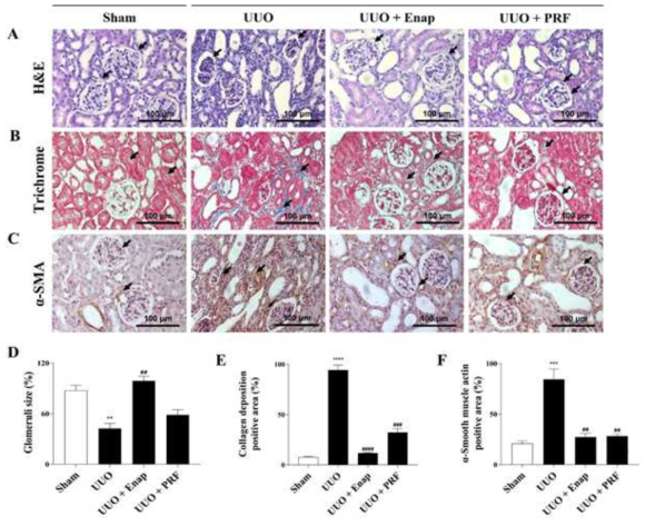 PRF relieves glomerular damage and decreases collagen deposition in UUO-induced renal fibrosis. (A) Histopathology of renal fibrosis, (B) collagen deposition, (C) α-smooth muscle actin (α-SMA), (D) glomerulus size, (E) collagen deposition positive area, and (F) α-SMA expression positive area. Data are presented as means ± SD (n = 3). * p < 0.05, ** p < 0.01, *** p < 0.001, **** p < 0.0001 compared with the Sham group. # p < 0.05, ## p < 0.01, ### p < 0.001, #### p < 0.0001 compared with the UUO group