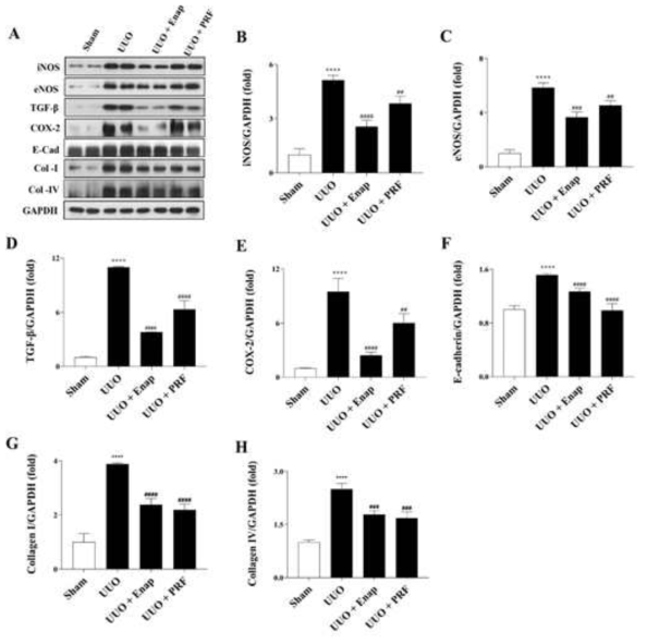 PRF suppressed the expression of inflammatory mediators in UUO-induced fibrosis. (A) Western blot analysis of inflammatory mediators, (B) iNOS, (C) eNOS, (D) TGF-β, (E) COX-2, (F) E-cadherin, (G) collagen I, and (H) collagen Ⅳ expression levels. Data are presented as means ± SD (n = 3). * p < 0.05, ** p < 0.01, *** p < 0.001, **** p < 0.0001 compared with the Sham group. # p < 0.05, ## p < 0.01, ### p < 0.001, #### p < 0.0001 compared with the UUO group