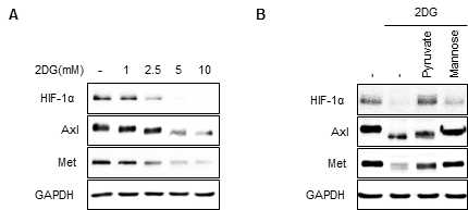 2DG에 의한 암대사 조절인자의 발현 결과