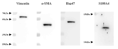 섬유아세포주의 vimentin, α-SMA, Hsp47, S100A4 발현확인