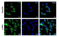 섬유아세포주의 vimentin, α-SMA 발현확인