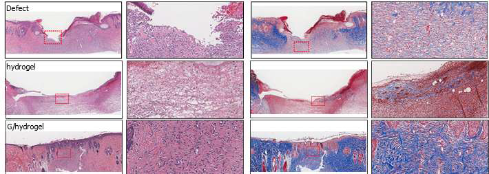 그래핀 터프하이드로젤의 피부 재생 조직학적 분석
