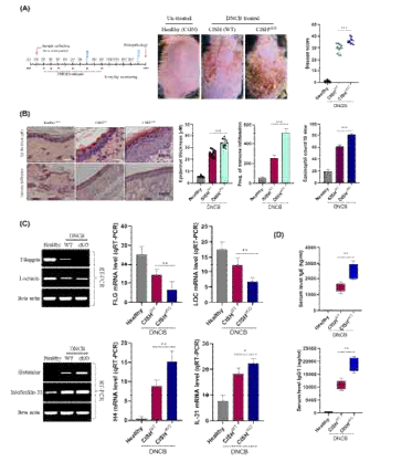 DNCB-induced Atopic Dermatitis is more severe in CD11c-cre x CISHfl/fl mice. (A) Study design. Representative mouse image with stastical disease score after DNCB-treatment (N=10). (B) Histopathological (H Filaggrin, Locracin, Histamine (H3) and IL-31expression after DNCB treatment. (D) Serum IgE and IgG1 level in CISHWT and CISHcKO mice after DNCB treatment