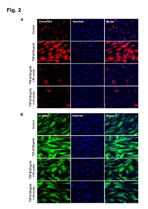 TGF-β1 투여로 활성화된 근 섬유아세포에 태반/탯줄 유래 중간엽 줄기세포 secretome (scrtm) 처리시 fibrosis marker가 감소함을 immunostainig로 확인함