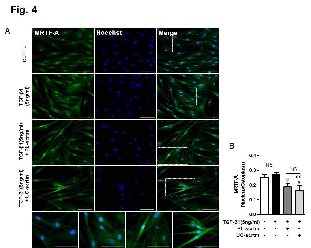 태반/탯줄 줄기세포 분비체 투여 시 MRTFA의 nuclear translocation 감소확인 (ICC)