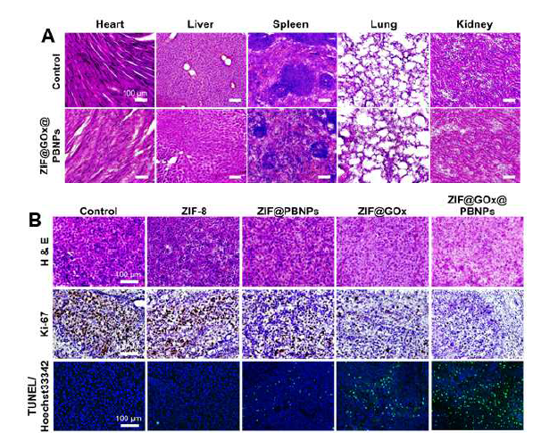 Histological analysis of five major organs and tumor tissues