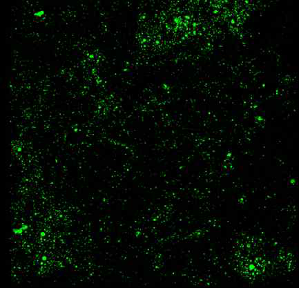 PLLA에 코팅된 헤파린에 고정화된 exosome