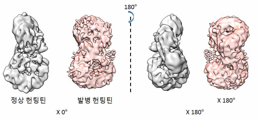 정상 헌팅틴 VPP 맵 (회색) 과 발병 헌팅틴 VPP 맵 (분홍색) 의 비교