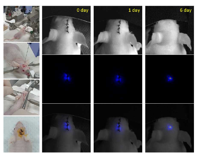 뇌에 삽입된 UCNPs 코팅된 마이크로입자의 in vivo 이미징