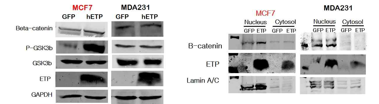 유방암 세 포주 모델에서 ETP 마커 발현을 조절에 의한 유방암 재발 대 표기전 WNT/β -catenin기전 마커 발현 검증