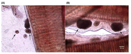 넙치 아가미조직에 기생한 C. irritans, (A) 침입자충, (B) 영양기 백점충