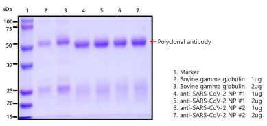 Anti-SARS-CoV-2 NP polyclonal antibody의 SDS-PAGE