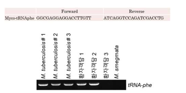 Core-gene tRNA-phe 진단 마커와 이를 이용한 PCR 산물