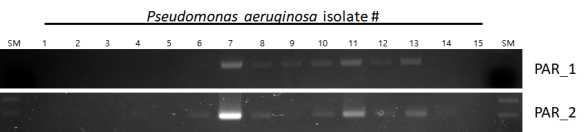 녹농균 슈퍼박테리아 분리균 15종을 대상으로 항생제 내성인자 바이오 마커를 이용한 진단. PCR 산물의 전기영동사진. lane SM; 1kb ladder, lane 2-16; 검체유래 슈퍼박테리아 녹농균 분리균들 1-15, PAR_1; 항생제 내성 진단마커 1, PAR_2; 항생제 내성 진단마커 2
