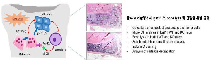 골수 미세환경에서 Igsf11 의 bone lysis 및 관절염 유발 규명