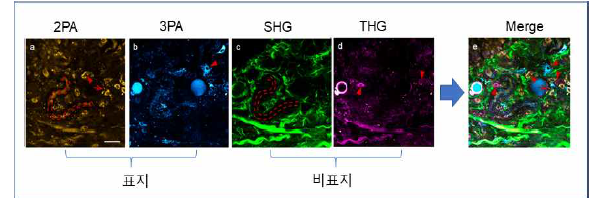 종양미세환경에서의 형광표지(2PA, 3PA), 비표지(SHG, THG) 영상