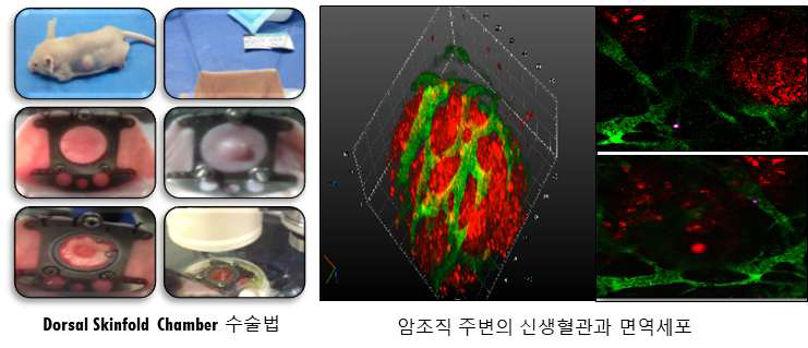 암조직 미세환경 영상분석 모델 제작