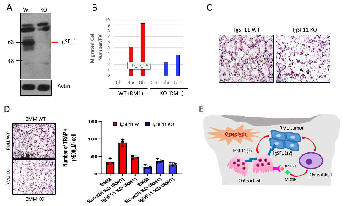 골수미세환경 내 뼈 전이 및 암발생에서 Igsf11의 조절 기능 규명