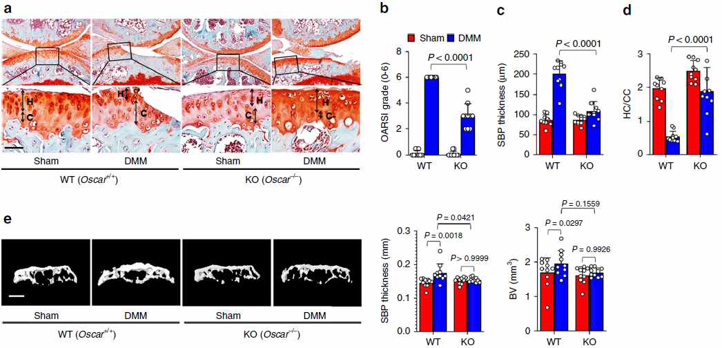 연골하뼈 및 관절에서 Oscar에 의해 골관절염 조절 기능 규명