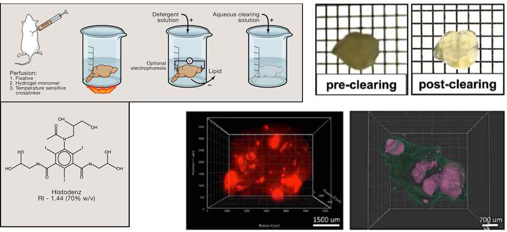 Hydrogel embedding을 통한 조직 투명화 개요(왼쪽 위, 아래) 및 투명화된 종양조직(오른쪽 위)과 imaris를 통해 3차원으로 재구성한 영상(오른쪽 아래)