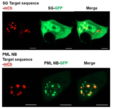 Confocal 현미경을 통한 Co-localization 이미지. Stress Granule (위), PML-NB (아래) Scale bar: 10 μm