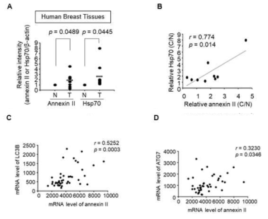 삼중음성 유방암 환자에서 annexin II와 Hsp70 및 오토파지 단백질 상관관계 확인