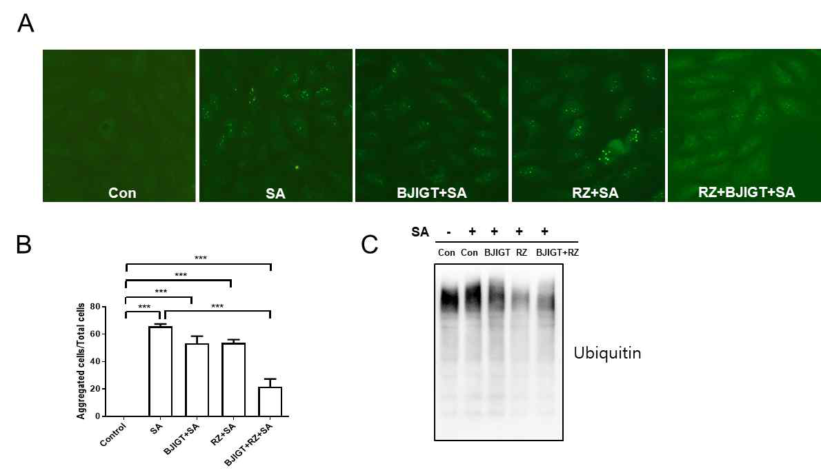 ALS 세포주에서 한·양약 병행투여가 SA로 인한 단백질 응집 억제 A-B: TDP43 세포주에서 SA처리에 의한 단백질 응집, C: 유비퀴틴 발현양 Con: control(TDP43 cells), SA: 150 μM sodium asenite(SA) 18시간 처리된 TDP43 cells, BJIGT+SA: 100 ㎍/ml BJIGT 6시간 전처리 후 150 μM SA 18시간 처리된 TDP43 cells, RZ+SA: 50 μM riluzole(RZ) 6시간 전처리 후 150 μM SA 18시간 처리된 TDP43 cells, RZ+BJIGT+SA: 50 μM RZ와 100 ㎍/ml BJIGT 6시간 전처리 후 150 μM SA 18시간 처리된 TDP43 cells