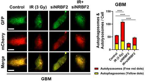 NRBF2의 선택적 제어에 따른 autophagosome 형성 분석