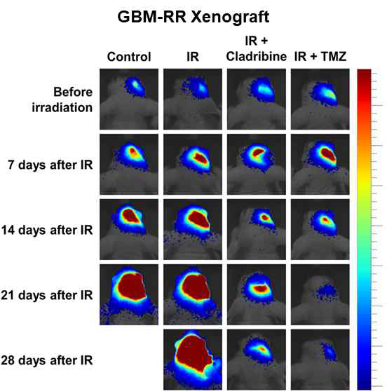 Cladribine과 TMZ 처리에 따른 마우스모델의 암 크기 변화