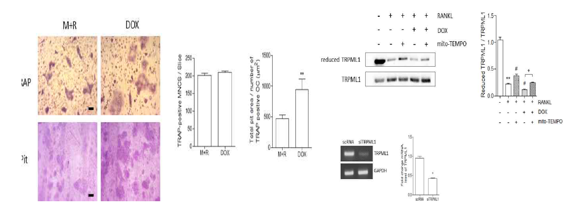 DOX는 파골세포의 골흡수 저해하는데 이는 증가된 mitochondria ROS가 lysosome의 TRPML1산화를 통해서임