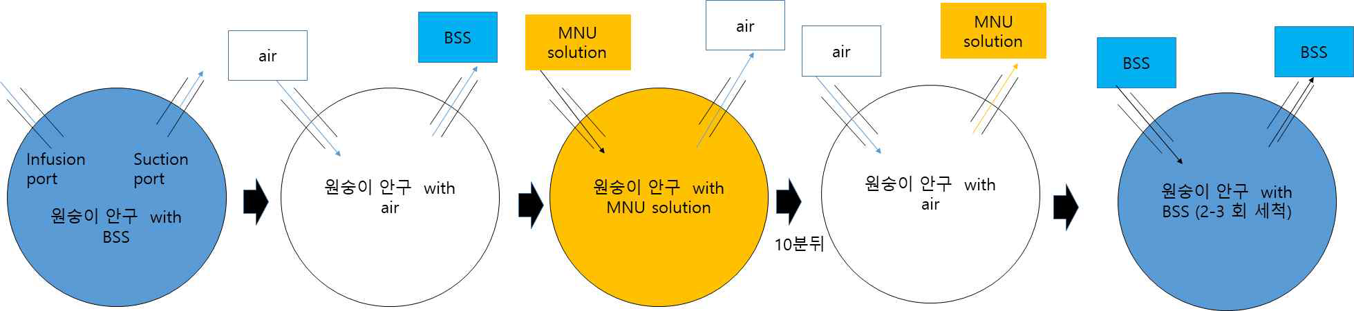 . 망막변성을 만드는 모식도