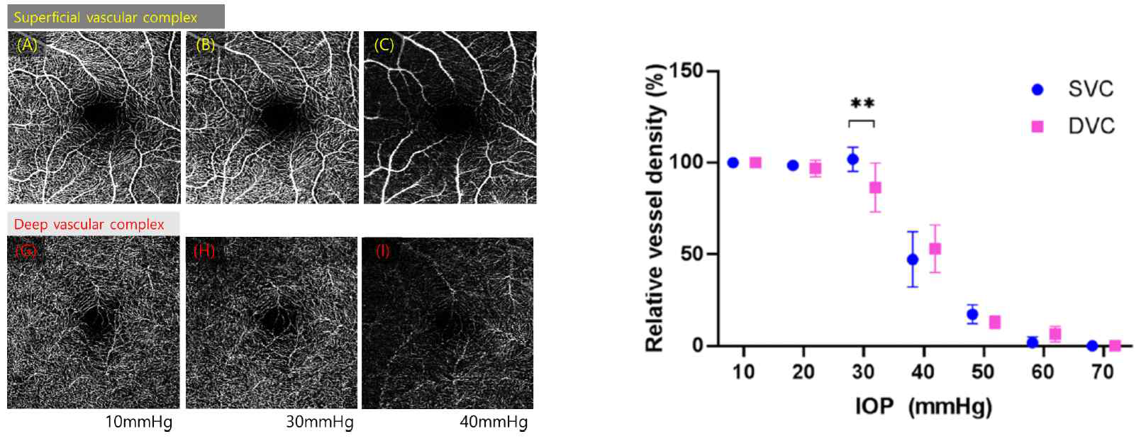OCTA를 사용하여 IOP 증가에 따른 망막혈관밀도 감소패턴을 관찰