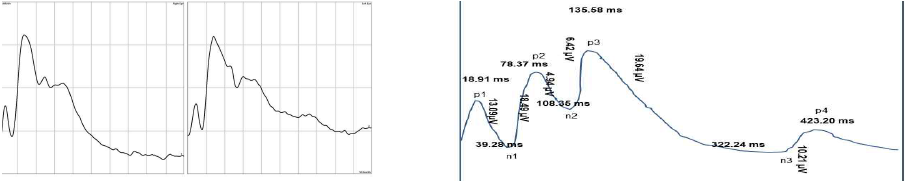 cynomolgus 원숭이에서 시행한 시각유발전위검사. 사람에서의 섬광시각유발전위검사가 지니는 전형적인 n1, p1, n2, p2, n3, p3와 달리 p1이 먼저 나오고 도달시간도 짧음. 이후 n1이 이어지고, bipeak모양으로 좀 더 늦게 상승곡선을 그리다가 이후 n3까지가 늦어지는 모습을 보임. 평균값으로 표현하자면 다음과 같이 p1파형의 도달시간이 18 msecond였고 n1파형의 도달시간은 39msecond, p2파형의 도달시간은 78 msecond, n2 파형의 도달시간은 108 msecond, p3파형의 도달시간은 135 msecond이며, 이후 n3파형 도달시간은 322 msecond, n4는 423 msecond 이었음