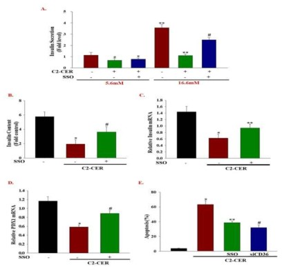 CD36 inhibition enhances GSIS and Insulin gene expression and insulin content