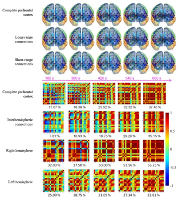 (위) 기능적 네트워크의 연결성 변화, (아래) 연결성 백분율이 표시 된 상관관계 지도