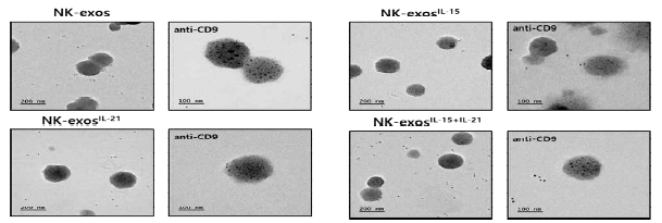 면역활성강화-NK 세포 유래 엑소좀 (NK-exoIL-15+IL-21) 형태 분석 (TEM)