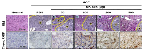 간세포암 동물모델 내 세포 사멸 (cell apoptosis) 정성적 분석 (H&E and IHC staining)