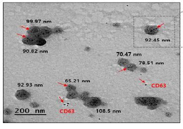 NK 세포 유래 엑소좀 이미지 분석