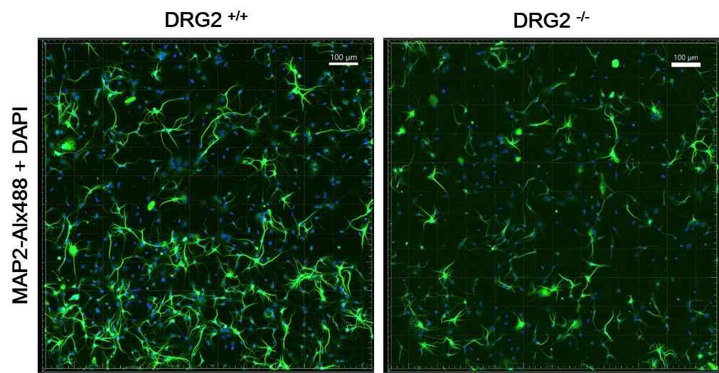 DRG2-WT/KO brain 신경초대배양을 통한 뇌신경세포의 형태변화를 관찰한 결과 DRG2-KO의 신경세포에서 신경가지와 Neurite의 길이가 줄어듬을 확인