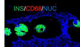 인슐린, CD68, 핵 면역염색 결과