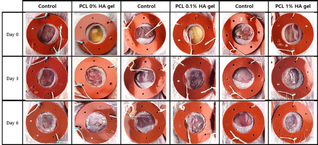 PCL 전기방사 섬유 조각 함량에 따른 HA gel의 피부 조직 재생 속도 비교
