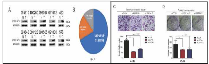 폐암환자에서 탈유비퀴틴화 효소 USP14이 증가 (A) 되어 있으며, 이를 감소시키면 세포 전이 (B) 및 성장 (C)이 감소함