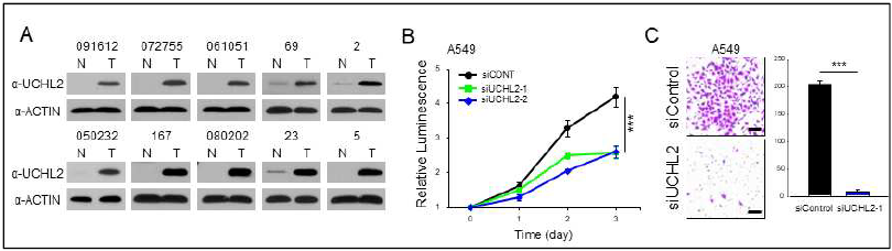 A. 폐암 및 정상조직에서 UCHL2의 발현정도, siRNA를 통한 폐암 성장(B) 및 전이(C)의 억제