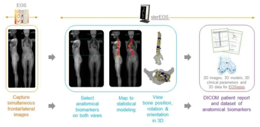 EOS system을 이용한 척추변형진단 model의 모식도