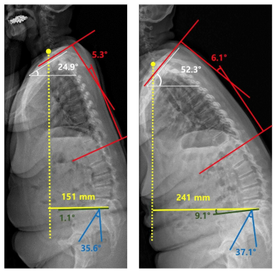 EOS 2D measurement 영상 데이터 분석