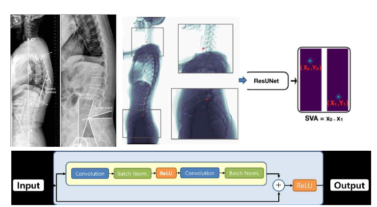 척추 parameter의 측정 및 인공지능 기반 measurement 알고리즘 개발