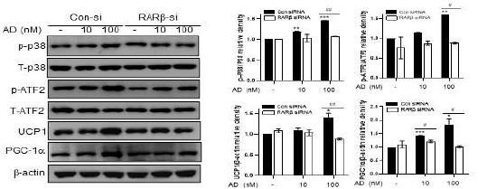 Adapalene에 의한 p38 MAPK-ATF2 phosphorylation에 RARβ knockdown 효과