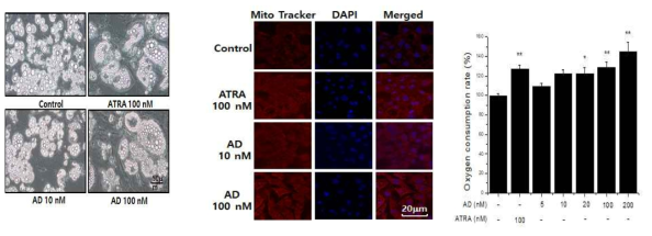 3T3/L1 adipocyte에서 adapalene에 의한 cell morphology 변화 및 mitochondria biogenesis 증가