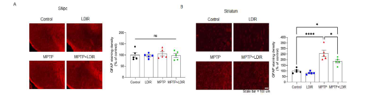 GFAP IHC 결과 (A) 흑질 (B) 선조체